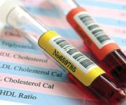 The Benefits of Extra Virgin Olive Oil