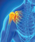 Cartilage Degradation