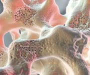 close up of bone material showing signs of osteoporosis