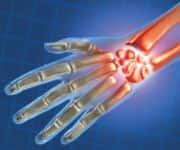 Graphic of inflamation