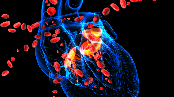 Atherosclerosis and Cardiovascular Disease