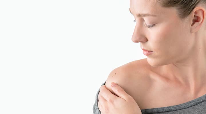 Woman examining mole