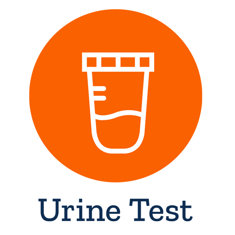 Urinalysis Urine Test