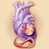 Coenzyme Q10 improves heart failure survival during two year trial