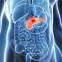 Higher plasma antioxidant levels associated with lower pancreatic cancer risk