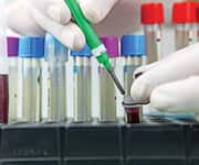 Skyrocketing Rates of Diabetes