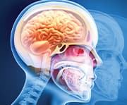 Branched Chain Amino Acids Boost Concussion Recovery