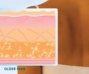 Older skin represented in layers