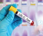 Cholesterol Myths: A Natural Alternative To Statin Drugs - Life Extension