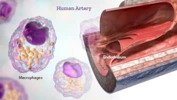 Diagram of human artery