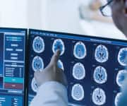 Doctors examining brain scans