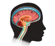 Cross section of brain and pineal gland