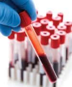 Blood vial going to be tested for statins levels