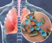 Pair of lungs being supported by taurine and being resistant to K. pneumonia