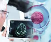 Researcher examining brain scan of mouse being supplemented with taurine