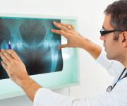 Doctor examining hip x-ray of patient using multivitamin to lower fracture risk