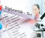 Lab technician using blood sample to test for triglyceride levels