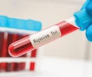 Blood vial with the label Magnesium Test being used to understand magnesium blood levels