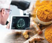 Researcher examining brain scan that is being supported by the active compound curcumin