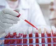 Lab technician spitting blood samples for testing the fatty acids, DHA and EPA, levels