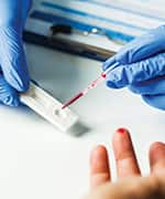 Lab technician taking blood from finger stick for omega-3 index