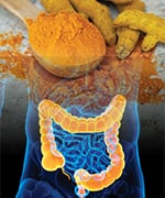 Diagram of intestine anatomy with bowel highlighted in orange getting curcumin placebo