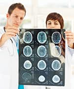 Pair of doctors examining printed brain scans from patient with low levels of ergothioneine