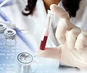 Lab technician holding up blood vial that is being used for testing insulin resistance and glucose levels