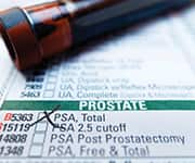 'Prostate cancer screening test with marked results