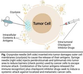 Diagram of a tumor cell undergoing cryo + Checkpoint inhibitor therapy