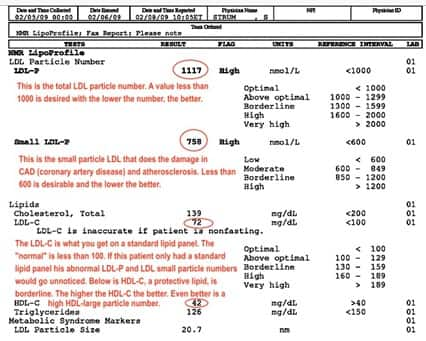 NMR LipoProfile