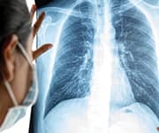 Doctor looking at x-ray of patient’s lungs for upper respiratory infection