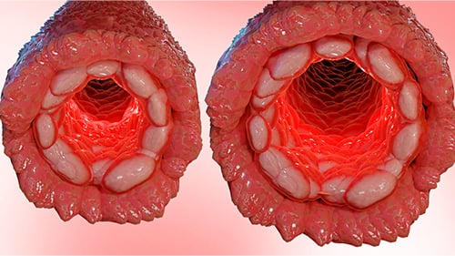 Two blood vessels that depicted a change in diameter for increased blood flow