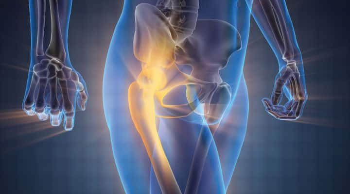 PQQ Reduces Arthritis Inflammation